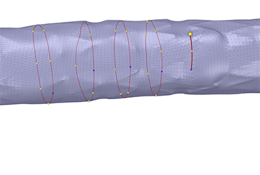 funcion stent